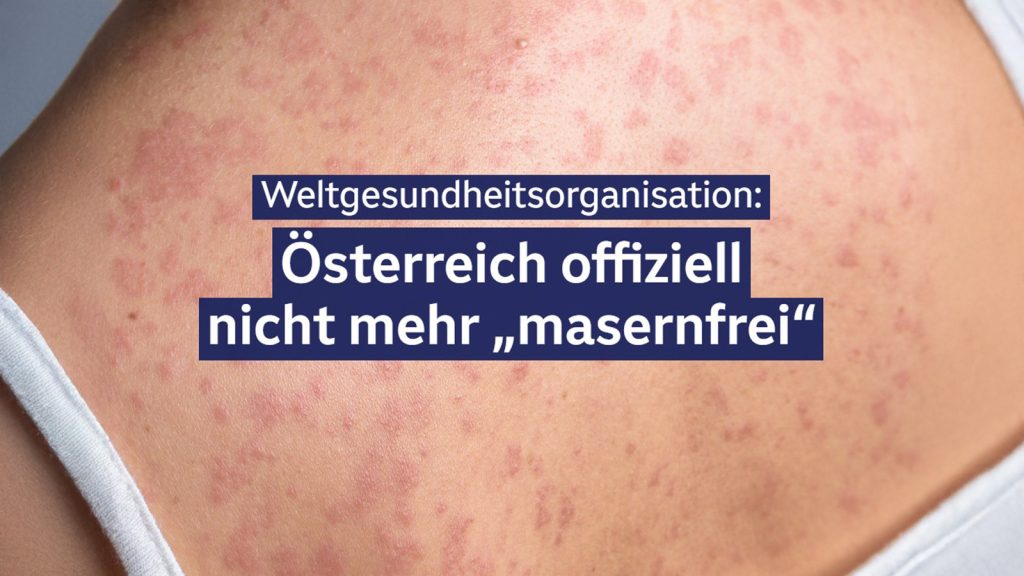 Das Bild zeigt eine ZIB-Meldung. Die Meldung liest sich "WHO: Österreich offiziell nicht mehr masernfrei".