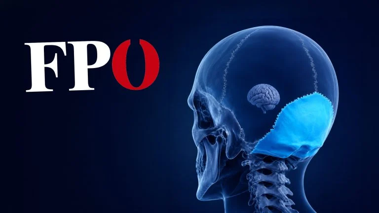 Arierknochen neben einem kleinen Gehirn, dazu FPÖ-Logo